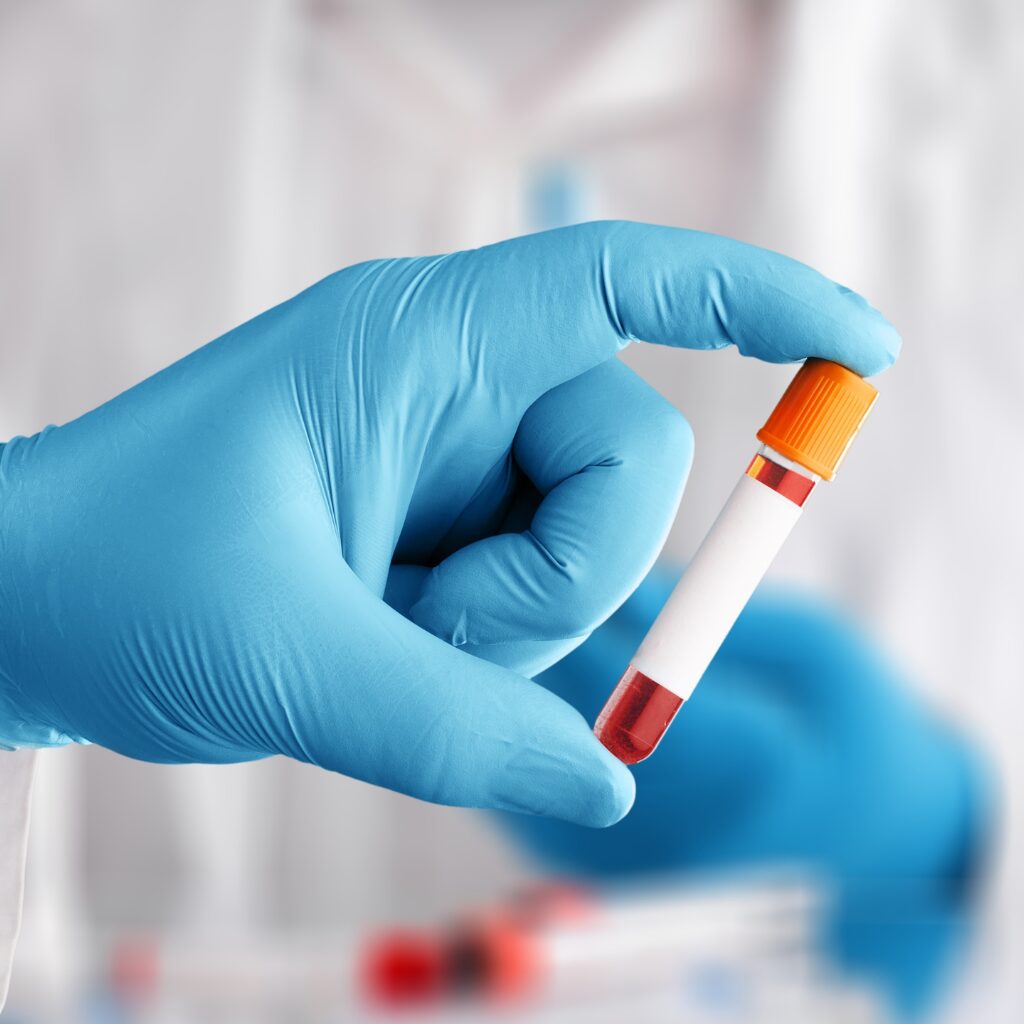 On-Site (Rapid) Testing: Is It Really Cost-Effective? On-Site (Rapid) Testing: Is It Really Cost-Effective?